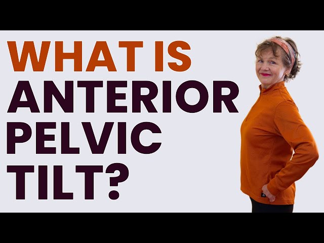 What is Anterior Pelvic Tilt?