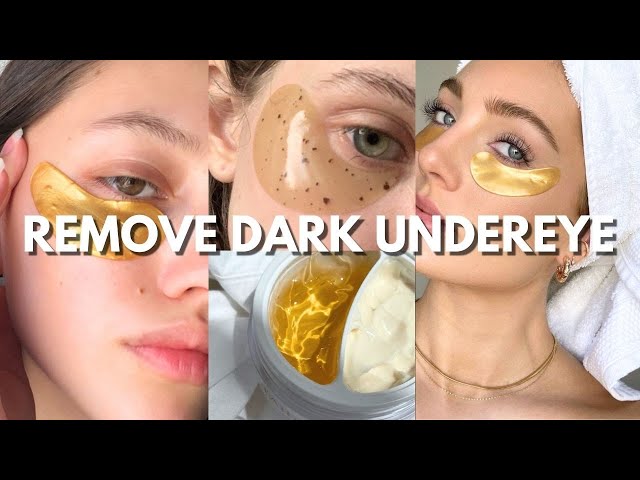 how to remove dark circles under eyes 👀🎀 beauty tips and natural remedies