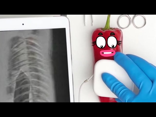 Pepper Needs Surgery Baby Birth | Funny video with Doodles | from Goodland