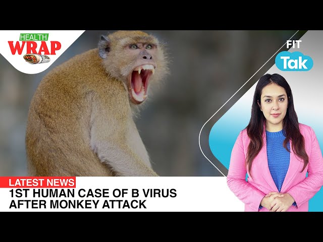 Hong Kong's first human case of B virus, Nestle India controversy | Health Wrap | Latest World News