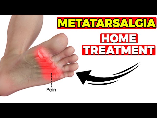 BEST Metatarsalgia Exercises, Massage & Stretches[HOME Treatment]