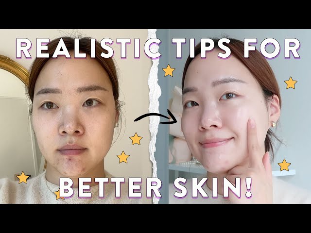 FINALLY NO ACNE😭  Realistic tips for glowing & healthy skin!