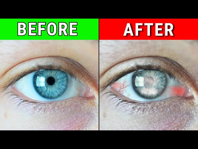 9 Habits (secretly) Ruining Your Eyes