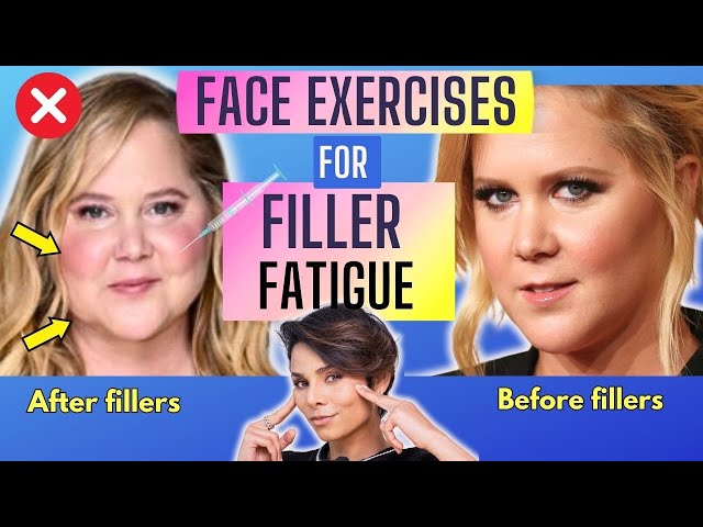 Face Exercises for Lower Face to Stop FILLER FATIGUE that's Weighing Your Face Down