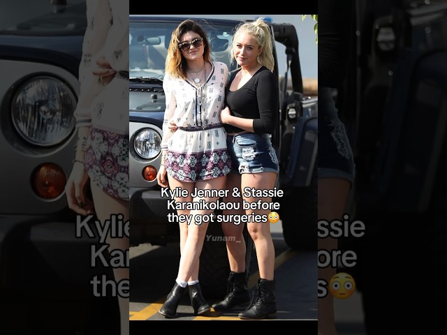 Kylie Jenner & Stassie before they got surgery😳#kyliejenner #celebrity #goviral #shorts #beautiful