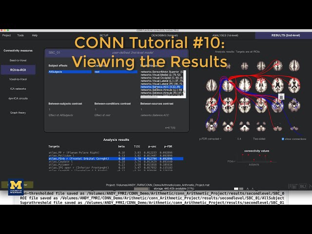 CONN Tutorial #10: Viewing the Results