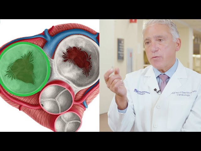 Advances in Transcatheter Tricuspid Valve Repair & Replacement with Dr. Charles Davidson