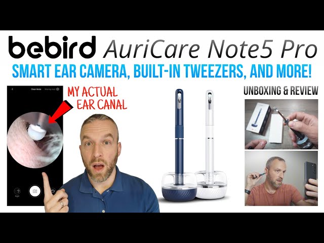 Bebird AuriCare Note5 Pro Review: Smart Ear Camera, Built-in Tweezers, and more!