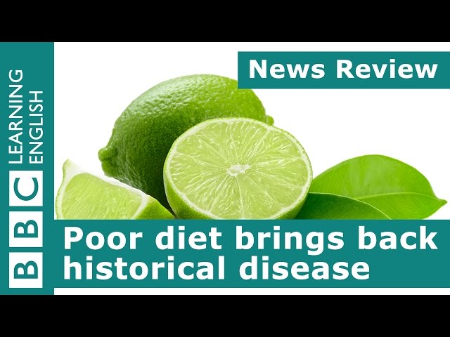 Poor diet brings back historical disease: BBC News Review