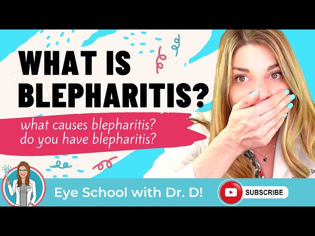 What is blepharitis? | What causes blepharitis? | Do you have blepharitis? | An Eye Doctor Explains