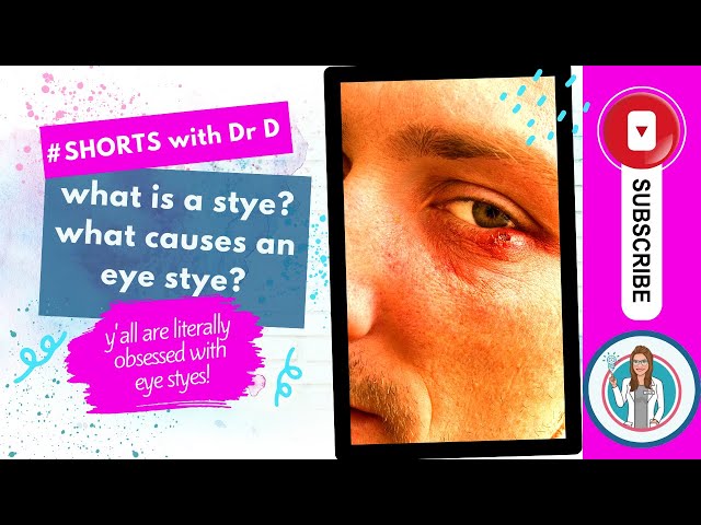 What is a Stye? What Causes an Eye Stye? What triggers an eye stye? #youtubeshorts #shortsyoutube