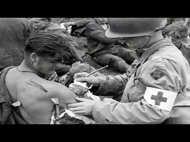 Medical Service in the Invasion of Normandy (1944)