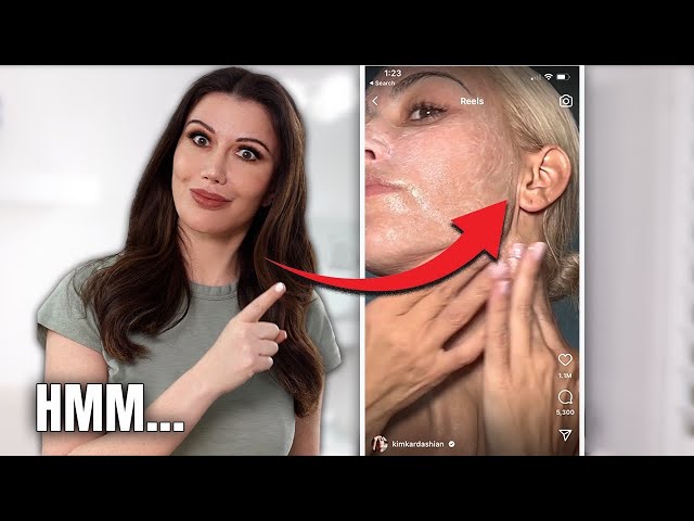 Kim K's Face Lift Scars: Hers VS Mine…