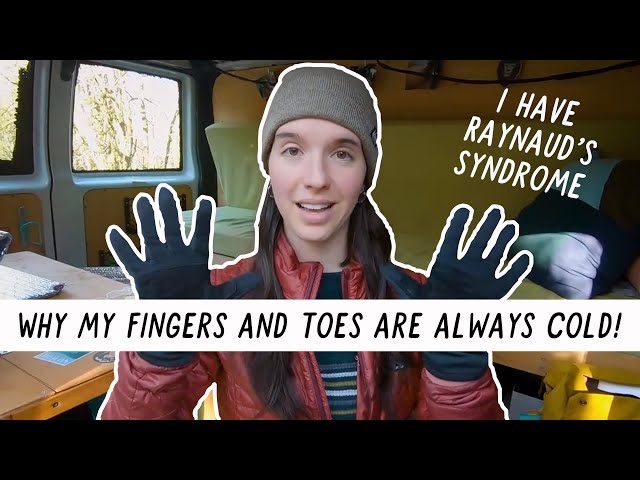 Why My Fingers and Toes are ALWAYS Cold! | Miranda in the Wild