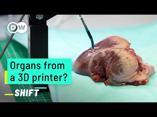 3D-printed hearts: A revolution for organ donations?