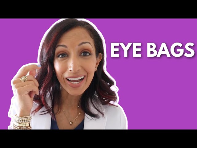 Eye Doctor Explains 5 Ways to Prevent Under Eye Bags & Circles