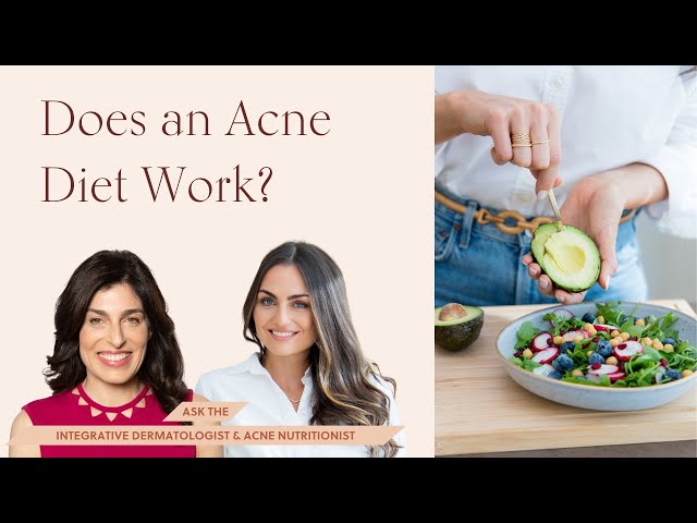 Does an Acne Diet Work? Dermatologist & Acne Nutritionist Weigh In