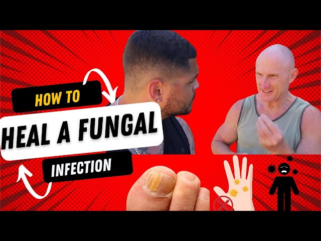 How To Heal A Fungal Infection With Paul Chek