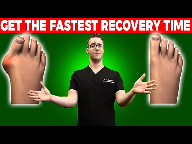 6 Best Bunion Surgery Pros & Cons [Get the FASTEST Recovery Time]