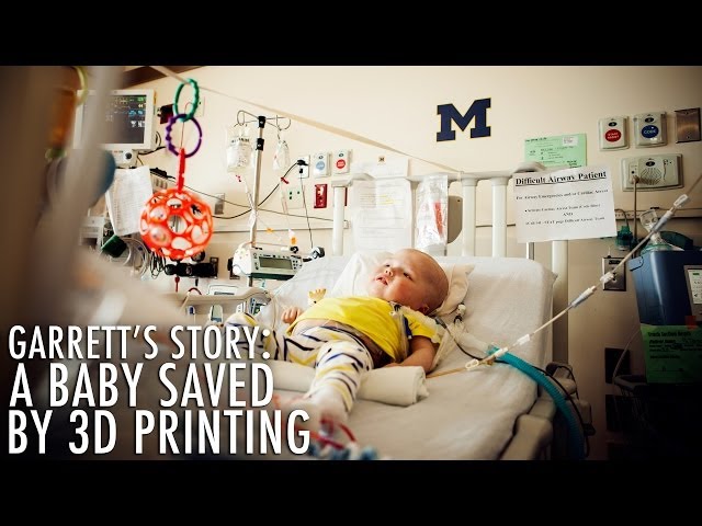 3D printed devices save baby's life at University of Michigan's C.S. Mott Children's Hospital