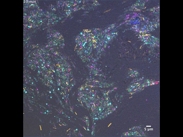 #NIDCR: Capnocytophaga gingivalis Shaping Bacterial Communities