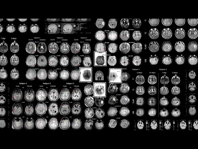 Accelerating discovery: The USC Mark and Mary Stevens Neuroimaging and Informatics Institute