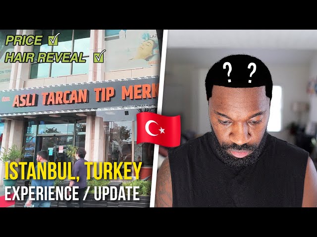 Hair Transplant Experience & Update | Asli Tarcan Hair Clinic | Istanbul, Turkey