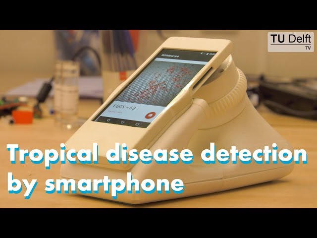 Tropical disease detection by smartphone