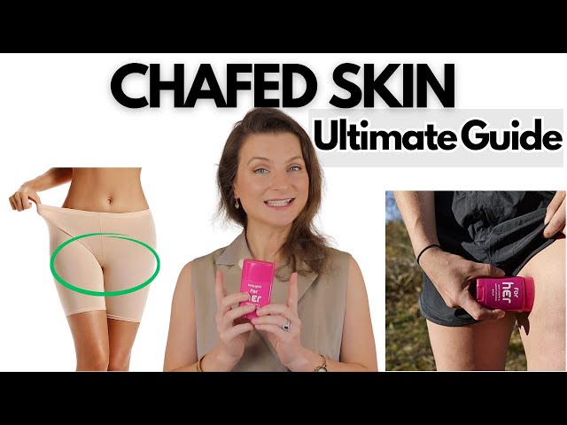 CHAFED SKIN: The Ultimate Guide To A Painless Summer
