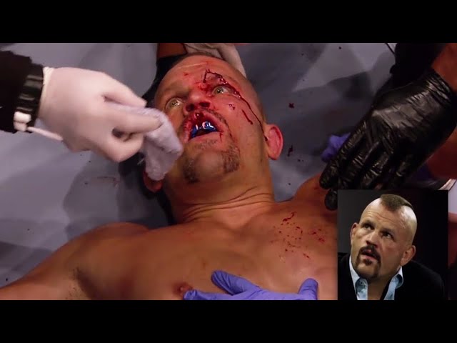 The Worst Career Ending in MMA History - Chuck Liddell | UFC