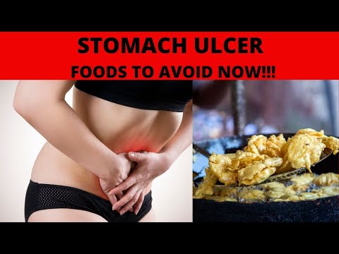 STOMACH ULCER | How to Heal a Stomach Ulcer | Stomach Ulcer Diet | Stomach Ulcer Treatment