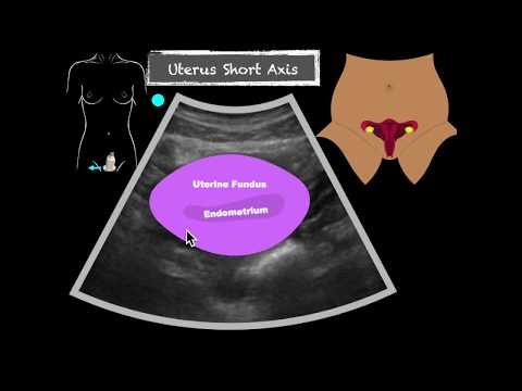 Female Pelvic Ultrasound OB/Gyn