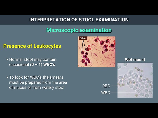 Interpretation of Stool Examination