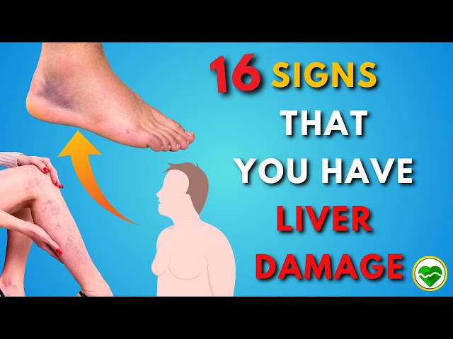 16 Signs of Cirrhosis You Should Never Ignore | Liver Disease | Warning Symptoms | Skin Issues