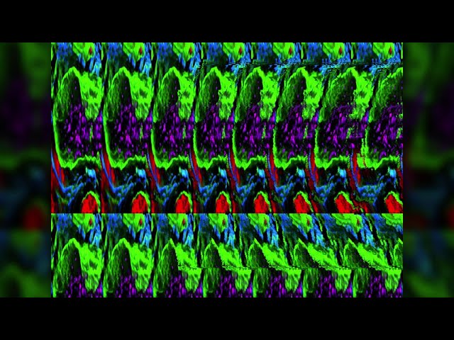 Magic Eye Pictures / 3D Stereograms for Eye Gymnastics / 3d video