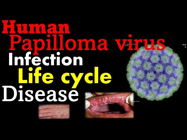 Human papillomavirus (HPV) | pathogenesis, infection, replication