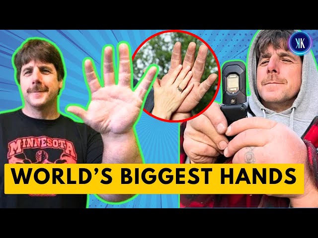 He Has The BIGGEST Hands In The World!