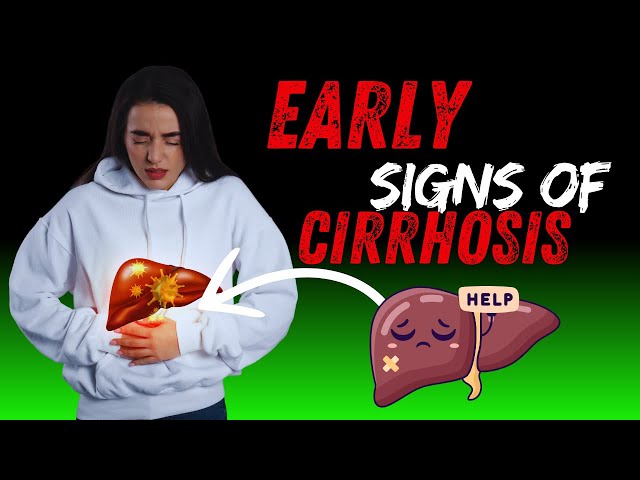 🍏 12 Early Signs of Liver Damage You Need to Know | Complete Guide to Liver Health | Wellness Way