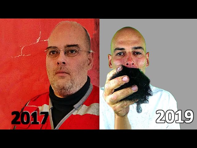 Bart abrasieren - nach zwei Jahren und 38 kg Gewichtsverlust