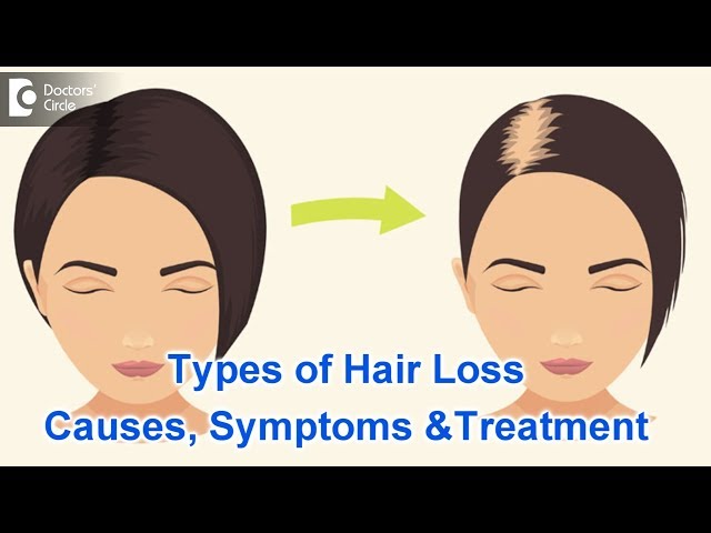 Types of Hair Loss | Common Causes, Symptoms & Treatment - Dr. Kavitha GV Mandal