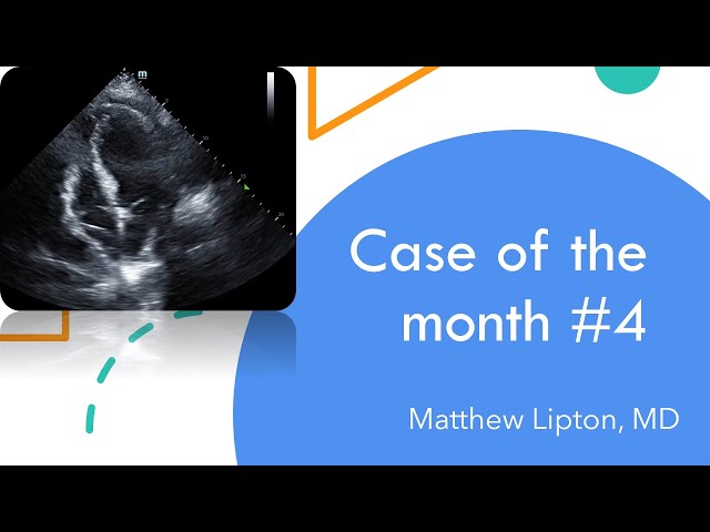 Case of the month #4