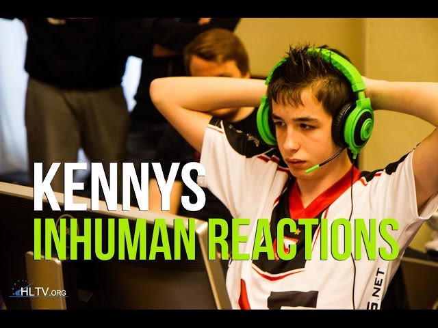 CS:GO - kennyS INHUMAN REACTIONS (Best Moments)