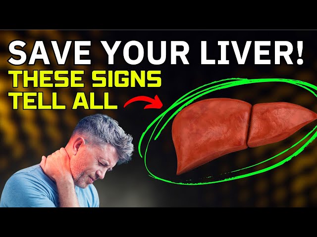 10 Liver Warning Signs: Is Your Liver in Danger?