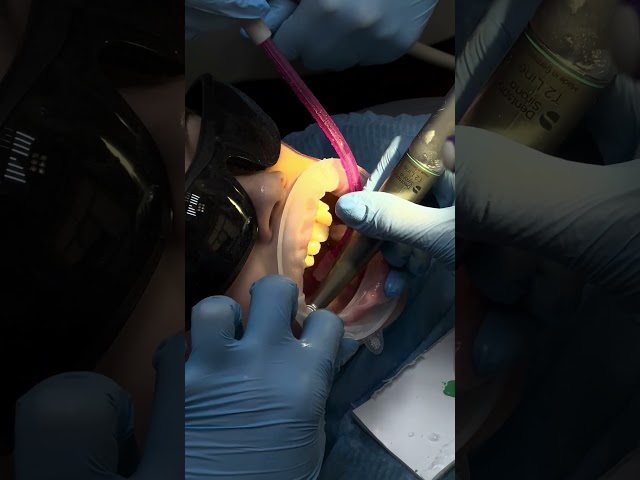 Как проходит профгигиена у детского стоматолога