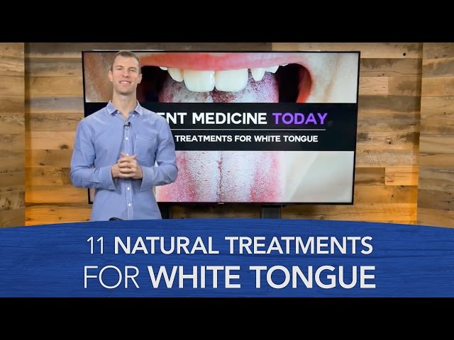 11 Natural Treatments for White Tongue