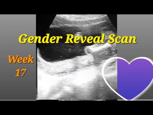 17 weeks pregnant scan baby boy or girl | 17 weeks pregnant  | 17 weeks and 5 days pregnant | gender