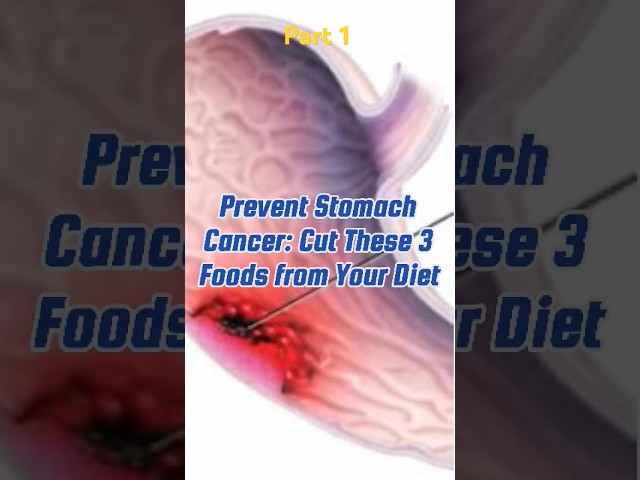 Prevent stomach cancer. Cut these 3 foods from your diet. Part 1 #health #shorts #fyp #cancer