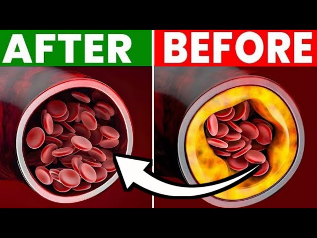The 5 Best MEAL to Clear Out Your Arteries _ Dr alia explains #dr alia