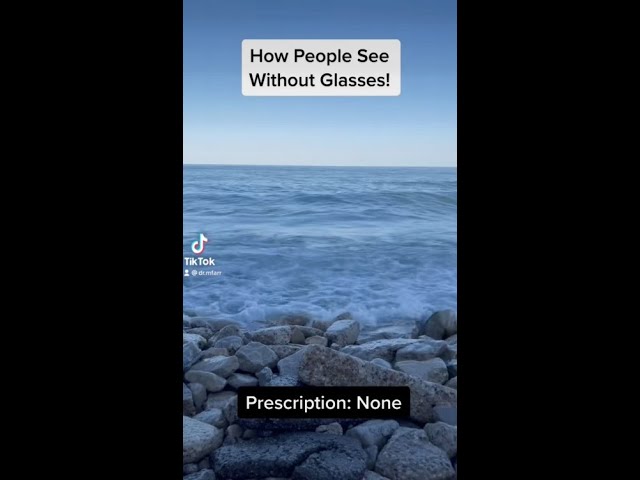 How People See Without Glasses! (Nearsighted/myopia) #shorts