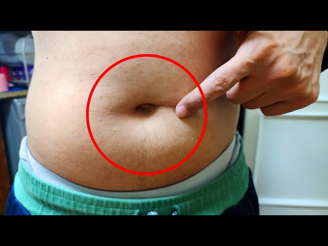 🌟 Can Castor Oil in Your Navel Transform Your Health? Discover Now!